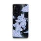 Angel Cloud Blue Huawei P20 Lite 5G Phone Case