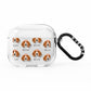 Beagle Icon with Name AirPods Clear Case 3rd Gen
