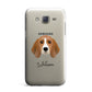 Beagle Personalised Samsung Galaxy J7 Case