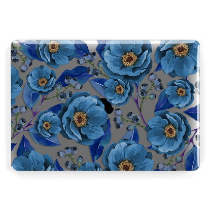 Blue Peonies Apple MacBook Case