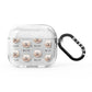 Bolognese Icon with Name AirPods Glitter Case 3rd Gen