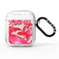 Crab AirPods Glitter Case