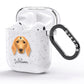 Golden Dox Personalised AirPods Glitter Case Side Image