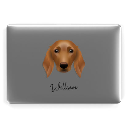 Golden Dox Personalised Apple MacBook Case