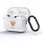 Morkie Personalised AirPods Pro Clear Case Side Image