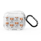 Parson Russell Terrier Icon with Name AirPods Glitter Case 3rd Gen