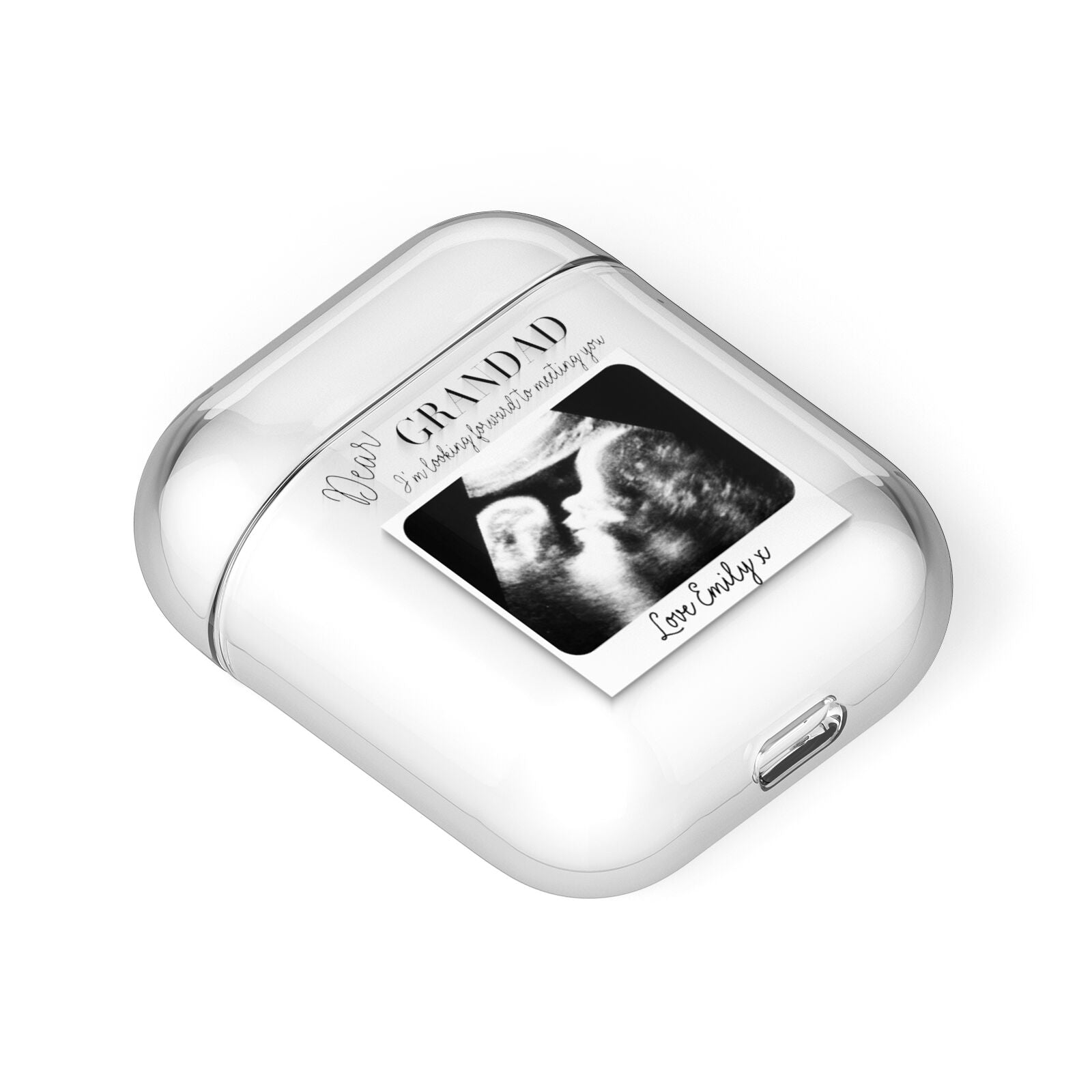Personalised Baby Scan Photo Upload AirPods Case Laid Flat