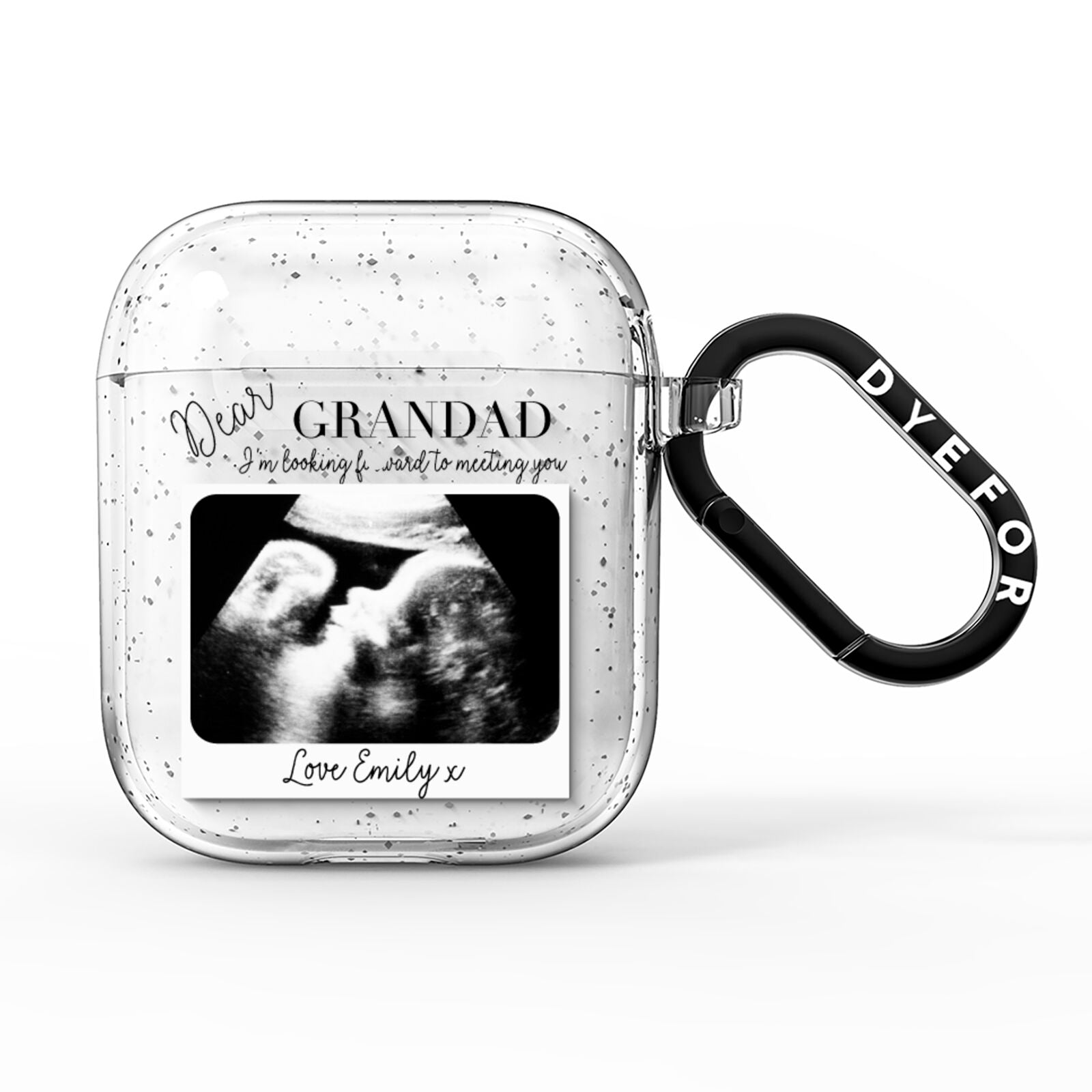 Personalised Baby Scan Photo Upload AirPods Glitter Case