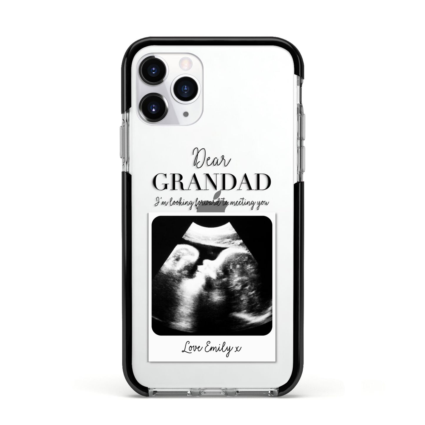 Personalised Baby Scan Photo Upload Apple iPhone 11 Pro in Silver with Black Impact Case