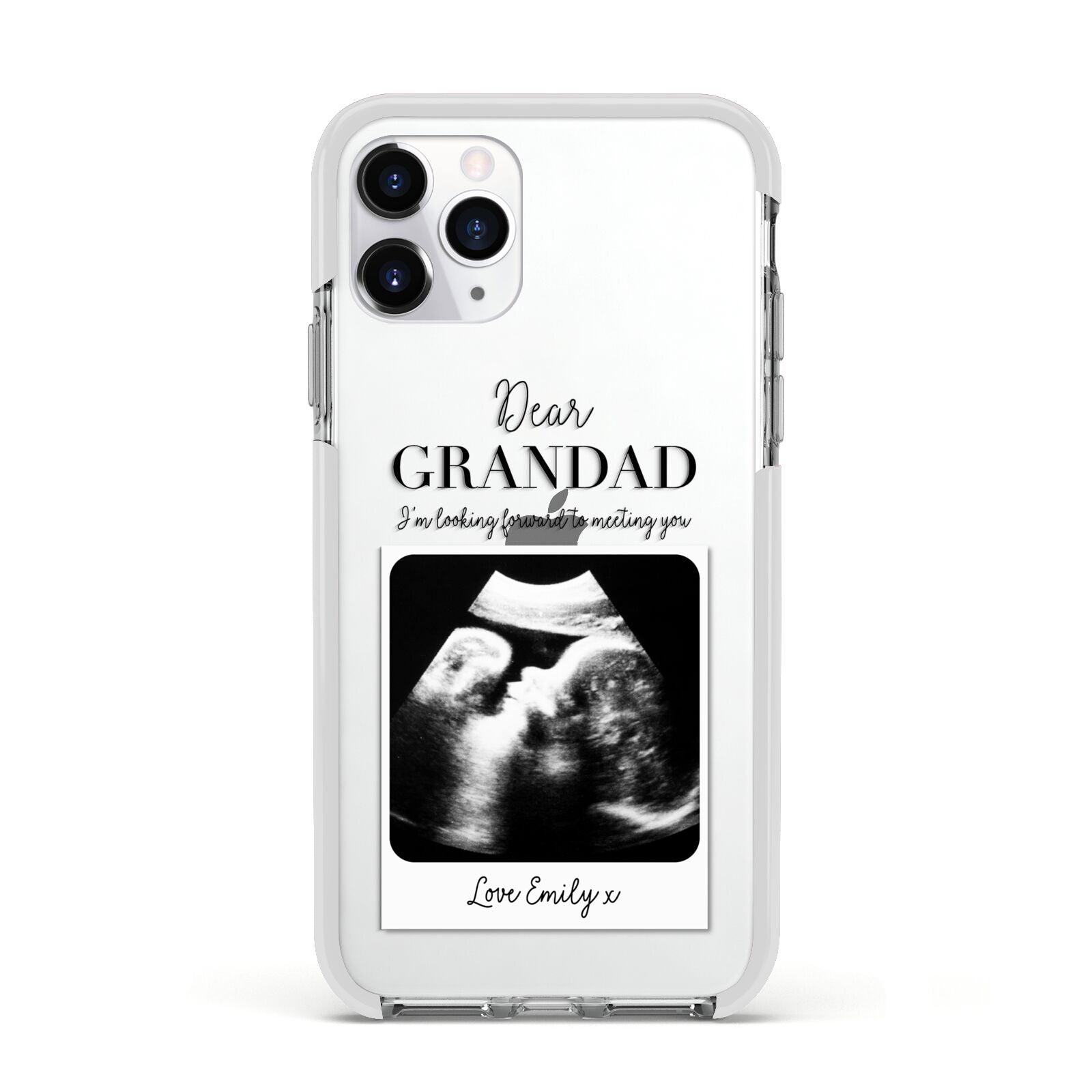 Personalised Baby Scan Photo Upload Apple iPhone 11 Pro in Silver with White Impact Case