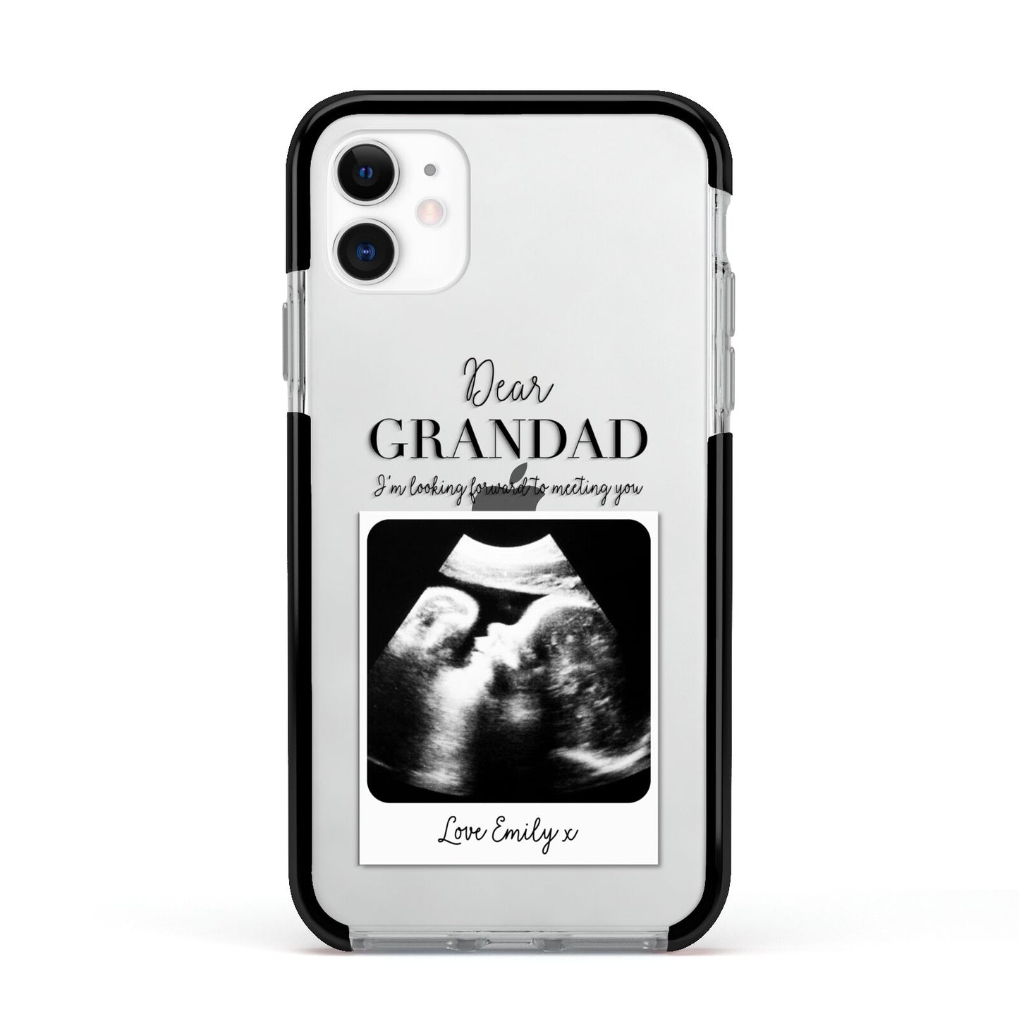 Personalised Baby Scan Photo Upload Apple iPhone 11 in White with Black Impact Case