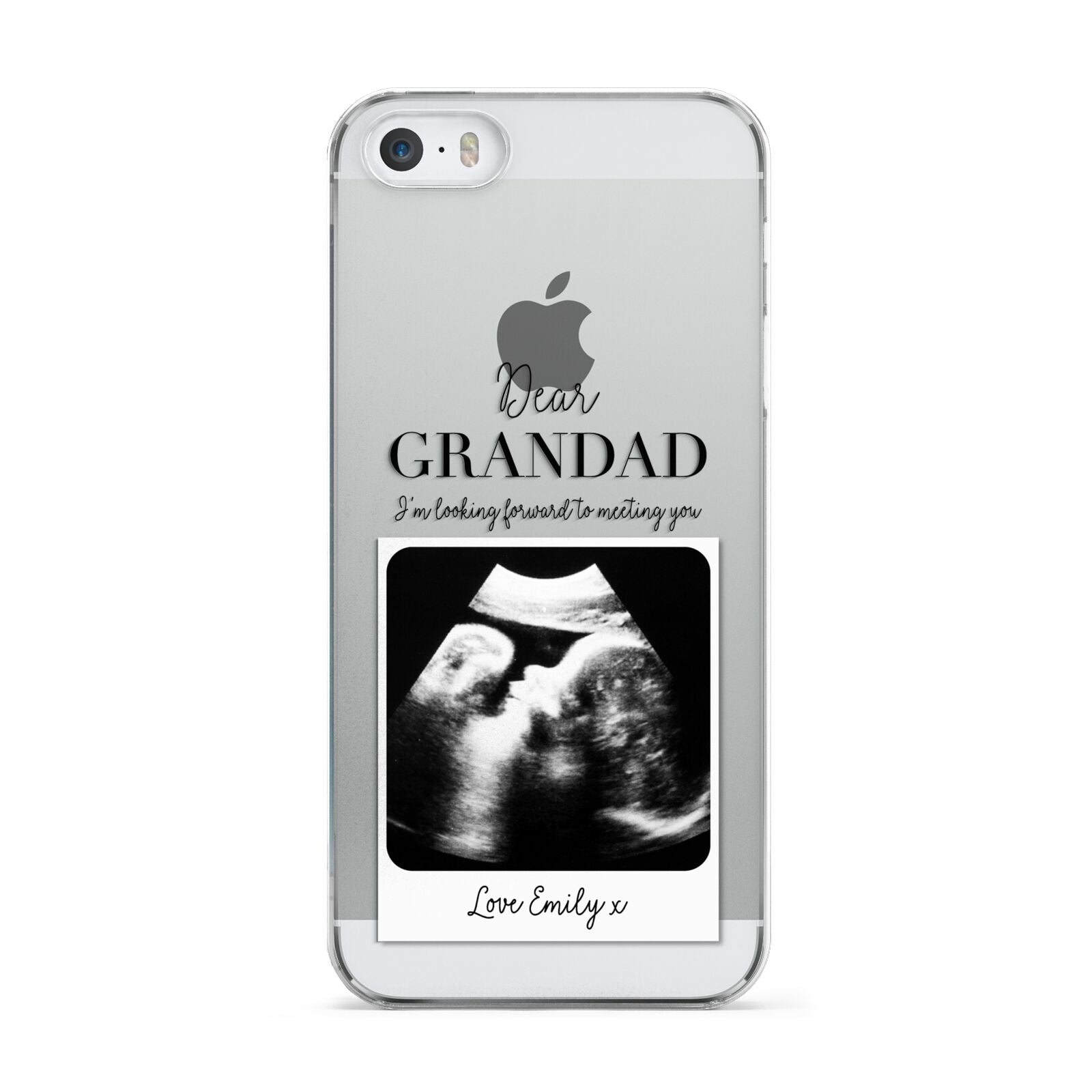 Personalised Baby Scan Photo Upload Apple iPhone 5 Case