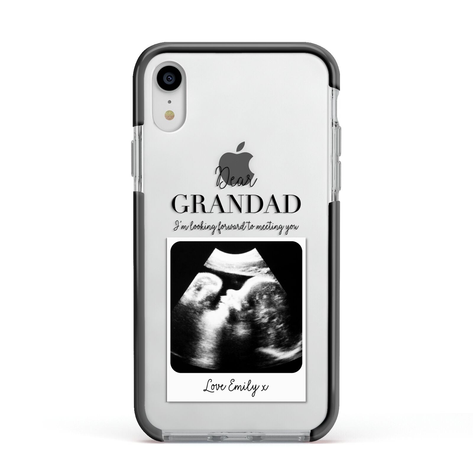 Personalised Baby Scan Photo Upload Apple iPhone XR Impact Case Black Edge on Silver Phone