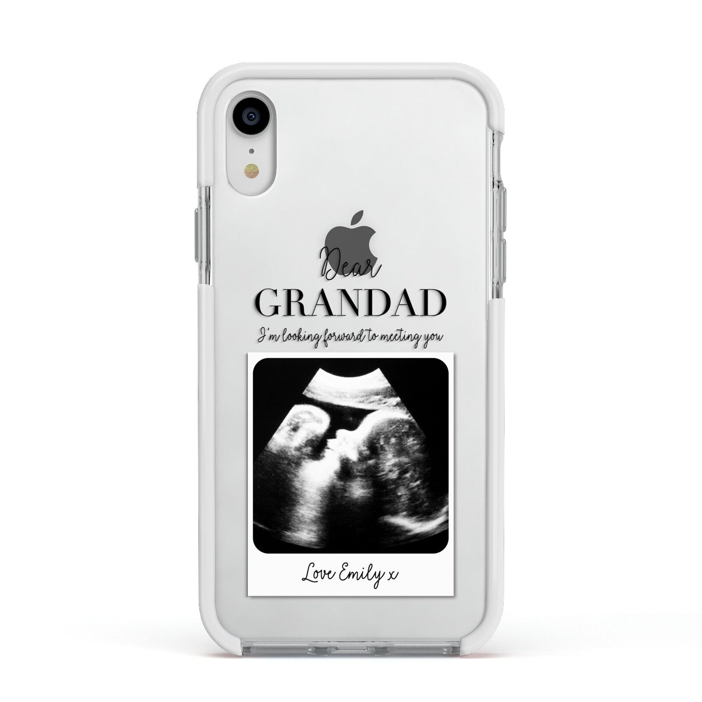 Personalised Baby Scan Photo Upload Apple iPhone XR Impact Case White Edge on Silver Phone