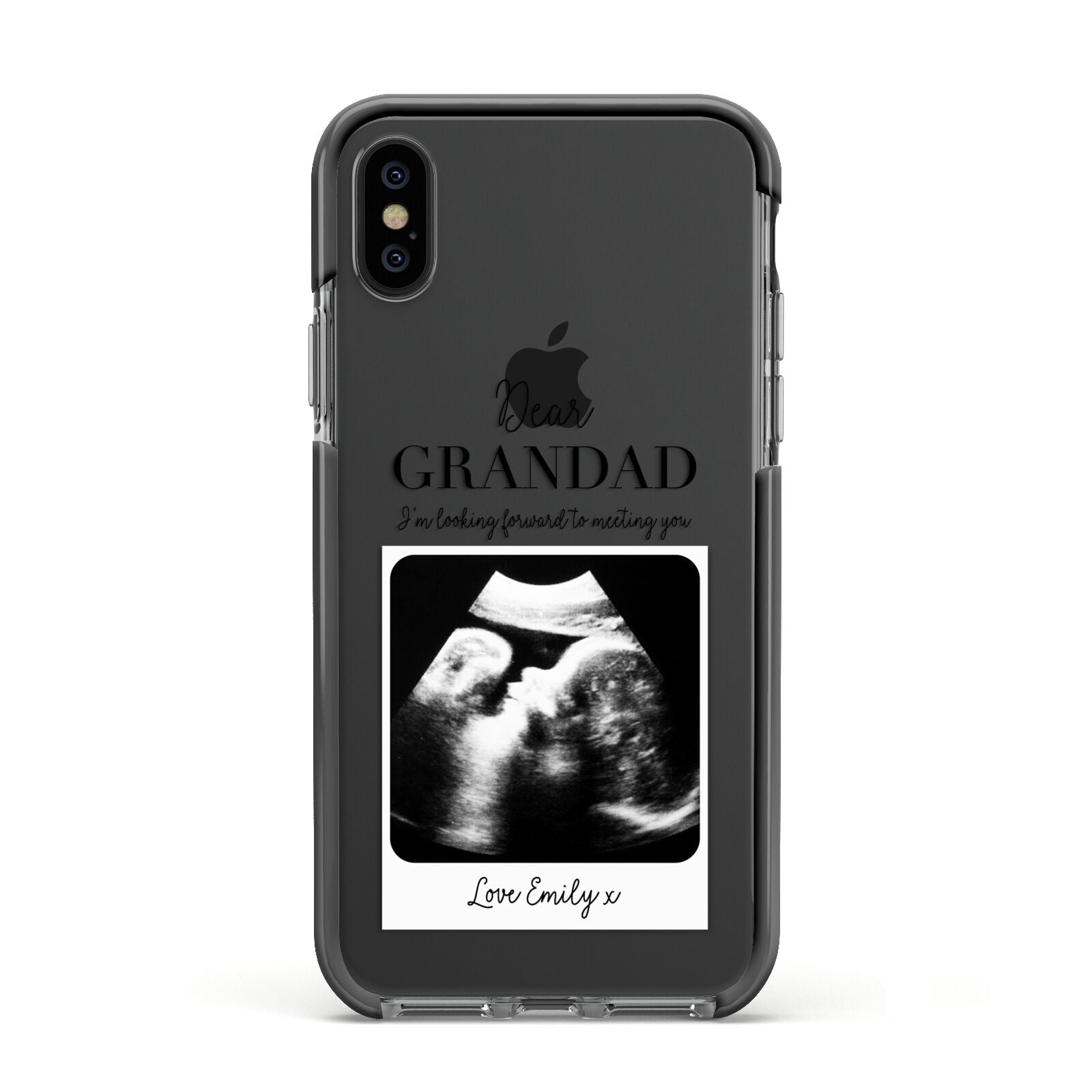 Personalised Baby Scan Photo Upload Apple iPhone Xs Impact Case Black Edge on Black Phone