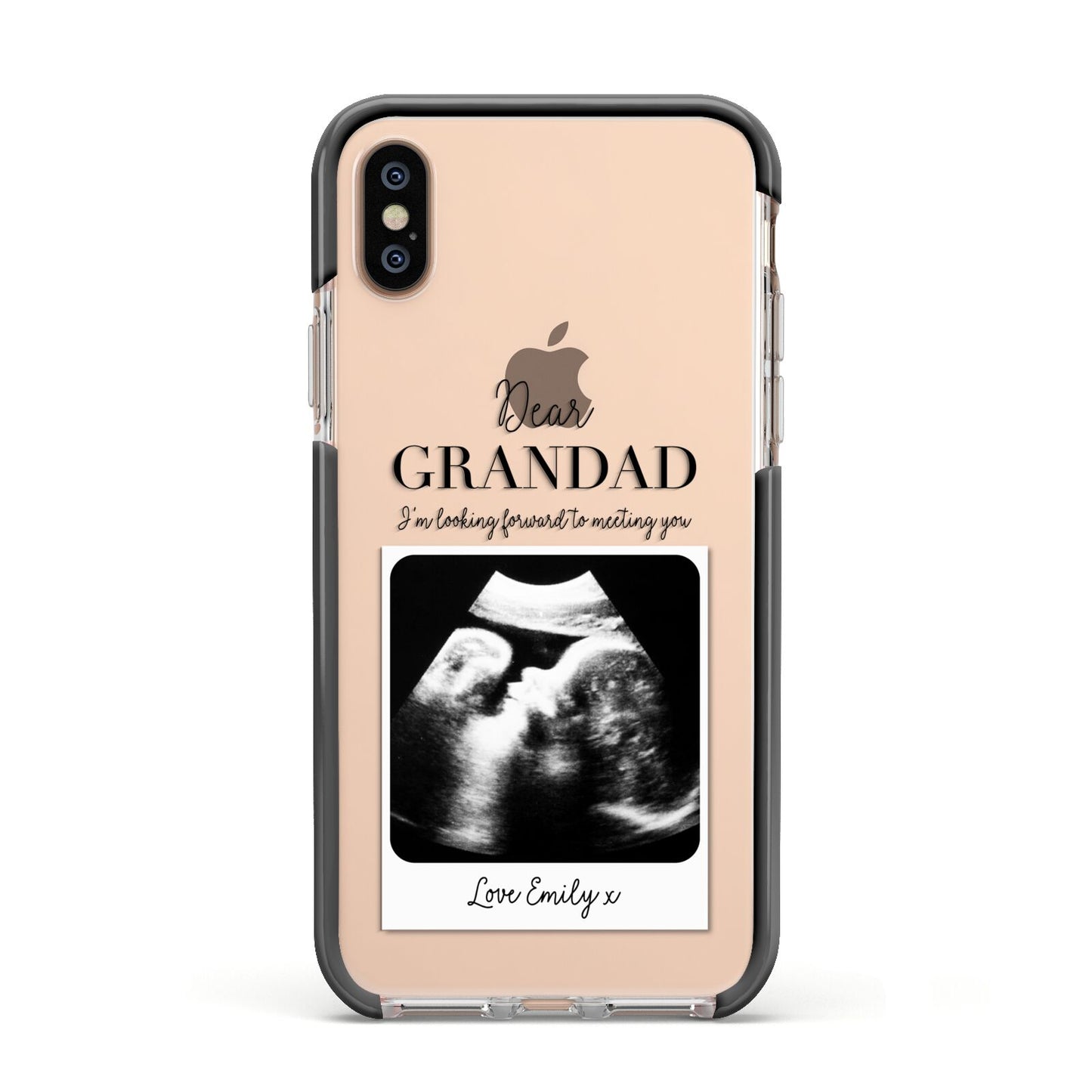 Personalised Baby Scan Photo Upload Apple iPhone Xs Impact Case Black Edge on Gold Phone