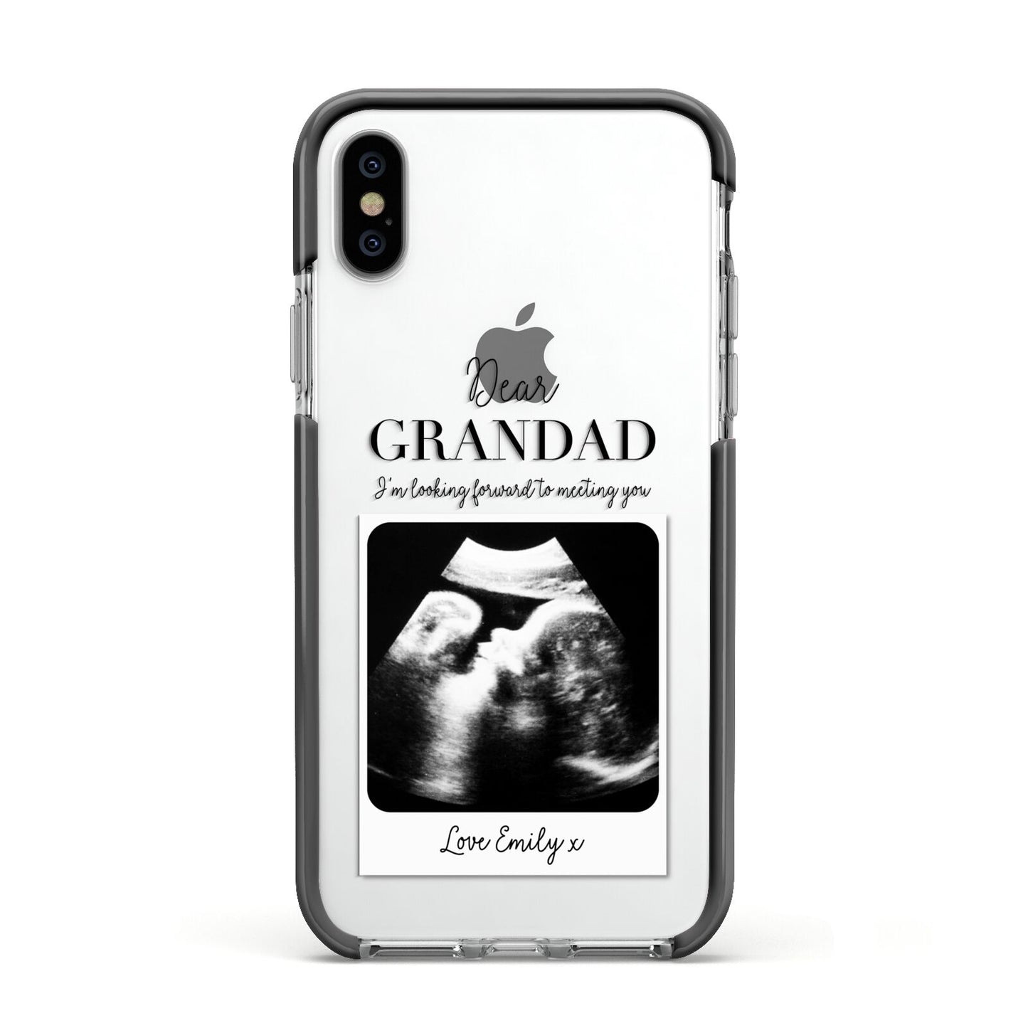 Personalised Baby Scan Photo Upload Apple iPhone Xs Impact Case Black Edge on Silver Phone