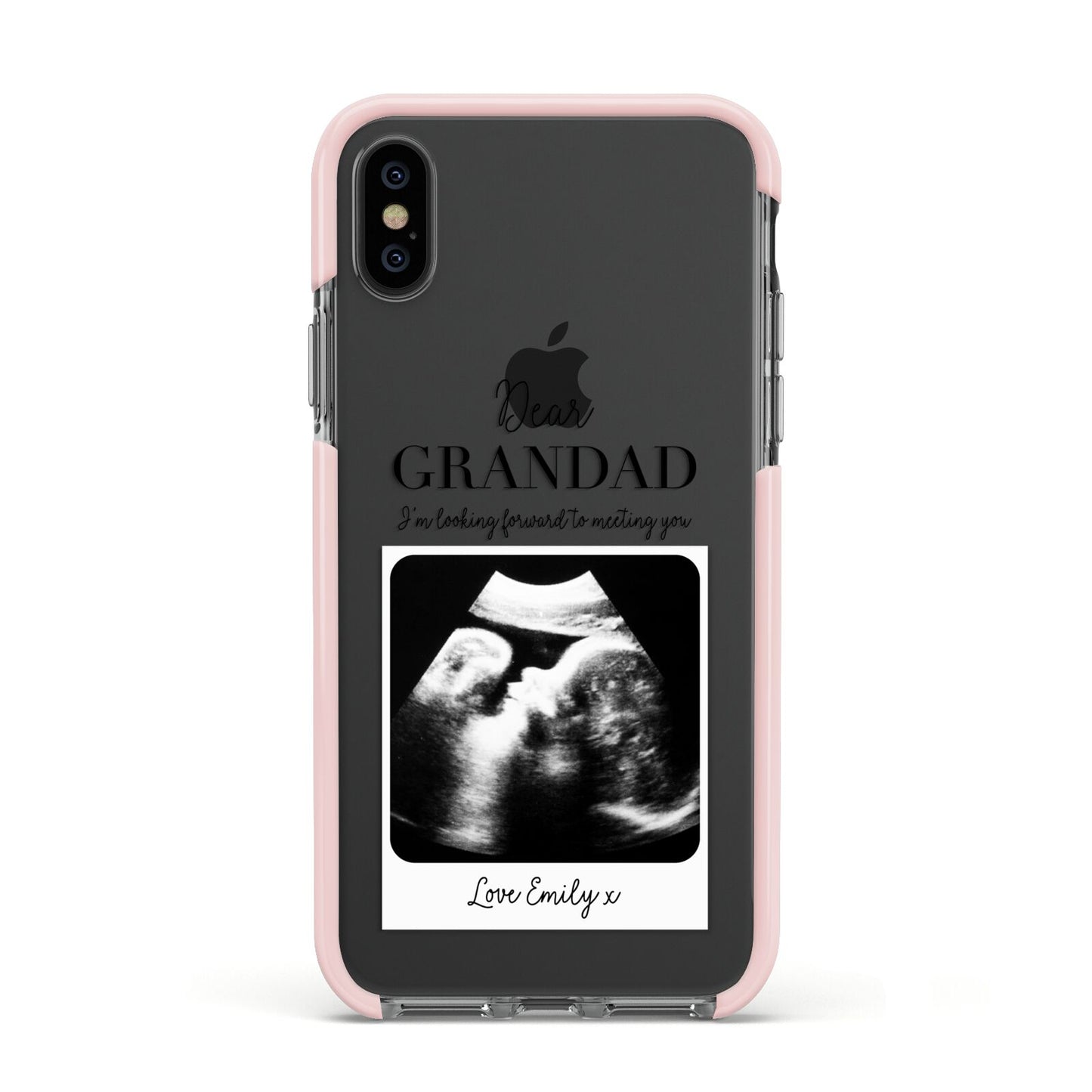 Personalised Baby Scan Photo Upload Apple iPhone Xs Impact Case Pink Edge on Black Phone