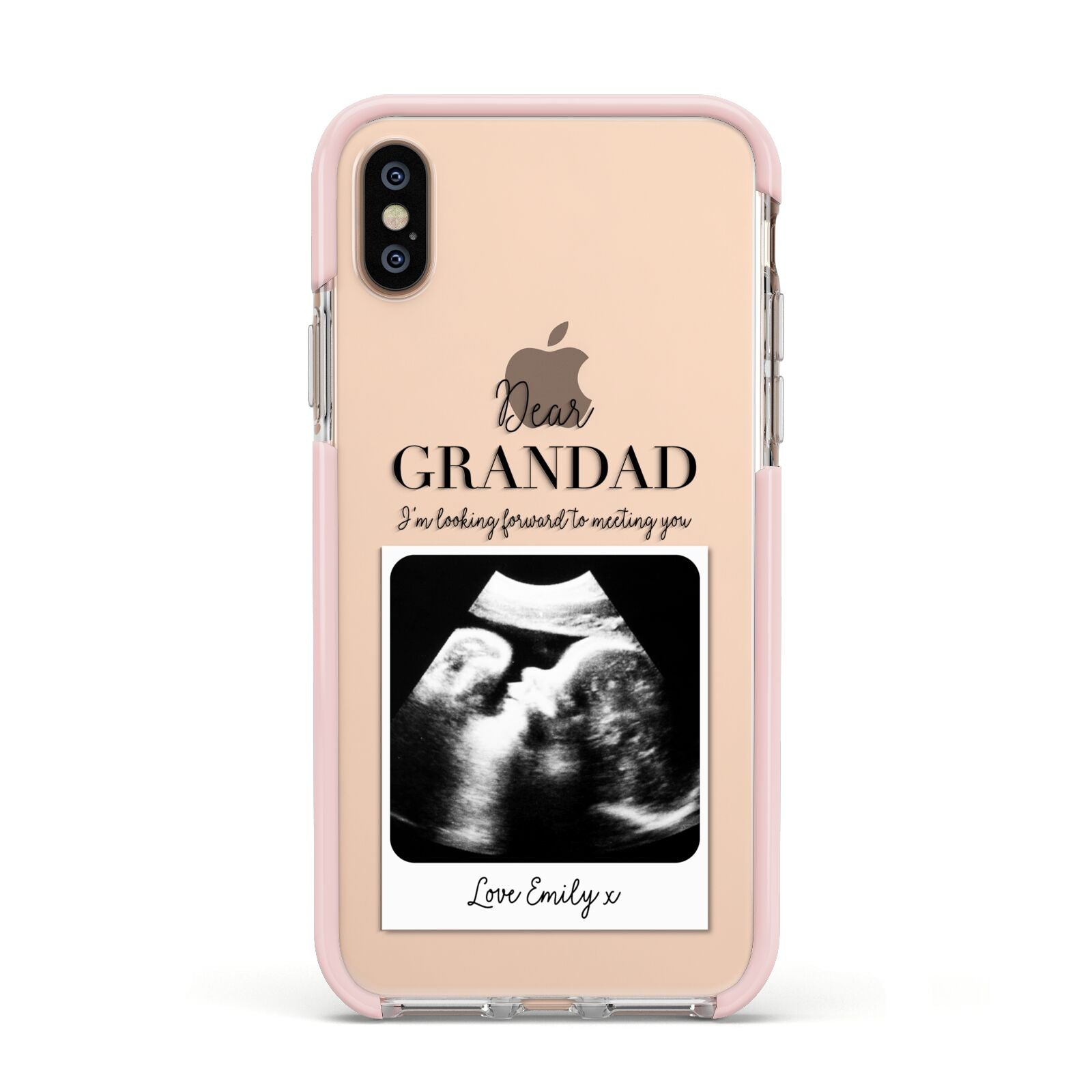 Personalised Baby Scan Photo Upload Apple iPhone Xs Impact Case Pink Edge on Gold Phone