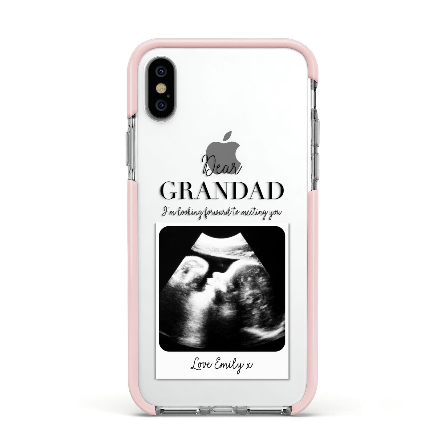 Personalised Baby Scan Photo Upload Apple iPhone Xs Impact Case Pink Edge on Silver Phone