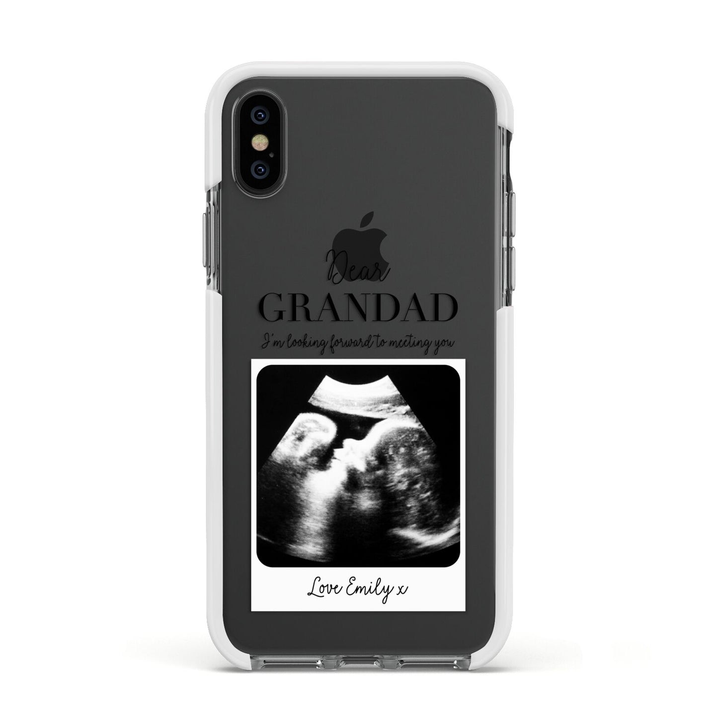 Personalised Baby Scan Photo Upload Apple iPhone Xs Impact Case White Edge on Black Phone