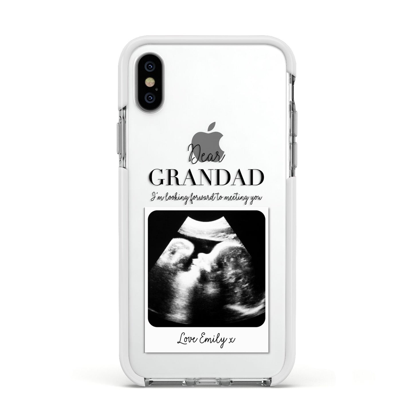 Personalised Baby Scan Photo Upload Apple iPhone Xs Impact Case White Edge on Silver Phone