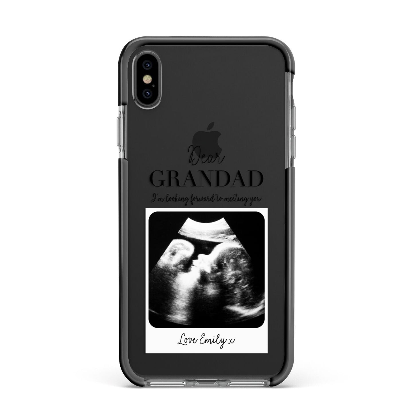 Personalised Baby Scan Photo Upload Apple iPhone Xs Max Impact Case Black Edge on Black Phone