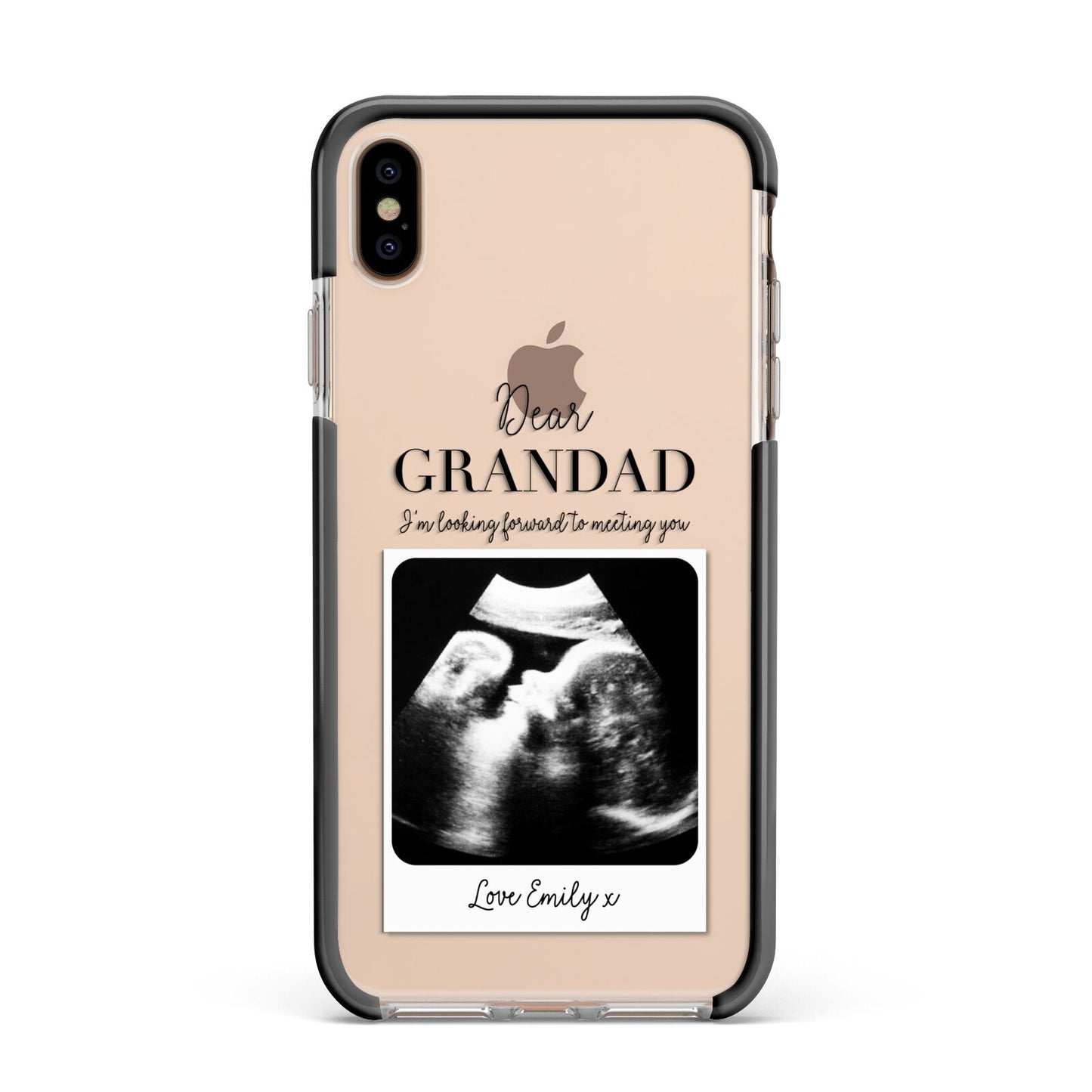 Personalised Baby Scan Photo Upload Apple iPhone Xs Max Impact Case Black Edge on Gold Phone