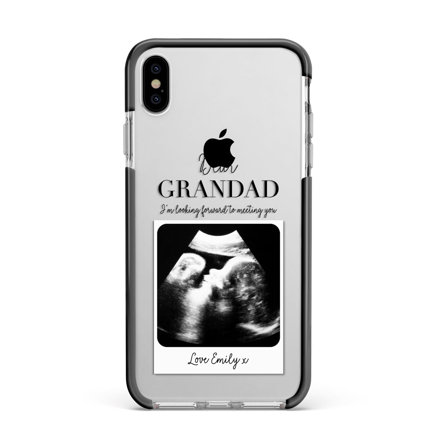 Personalised Baby Scan Photo Upload Apple iPhone Xs Max Impact Case Black Edge on Silver Phone