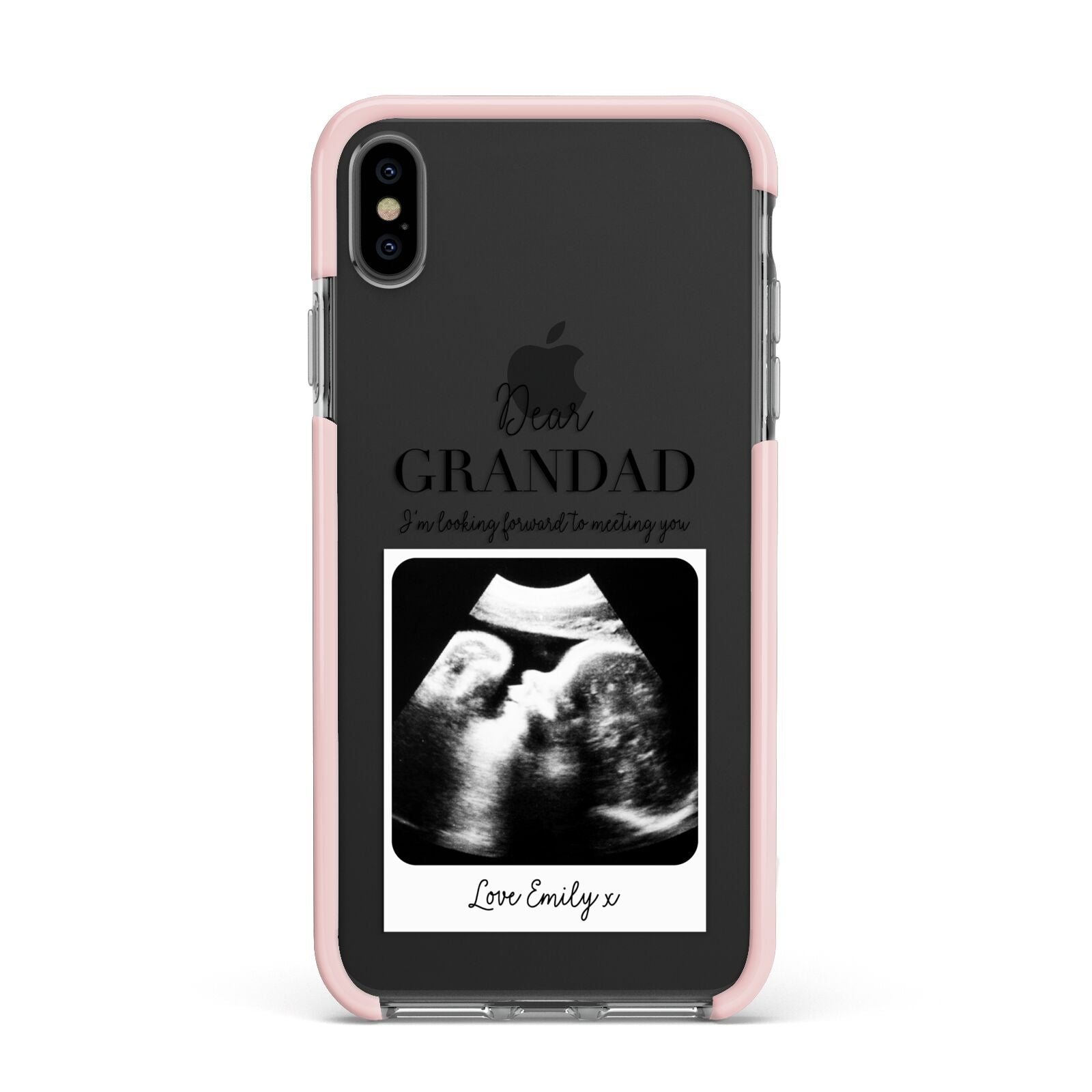 Personalised Baby Scan Photo Upload Apple iPhone Xs Max Impact Case Pink Edge on Black Phone