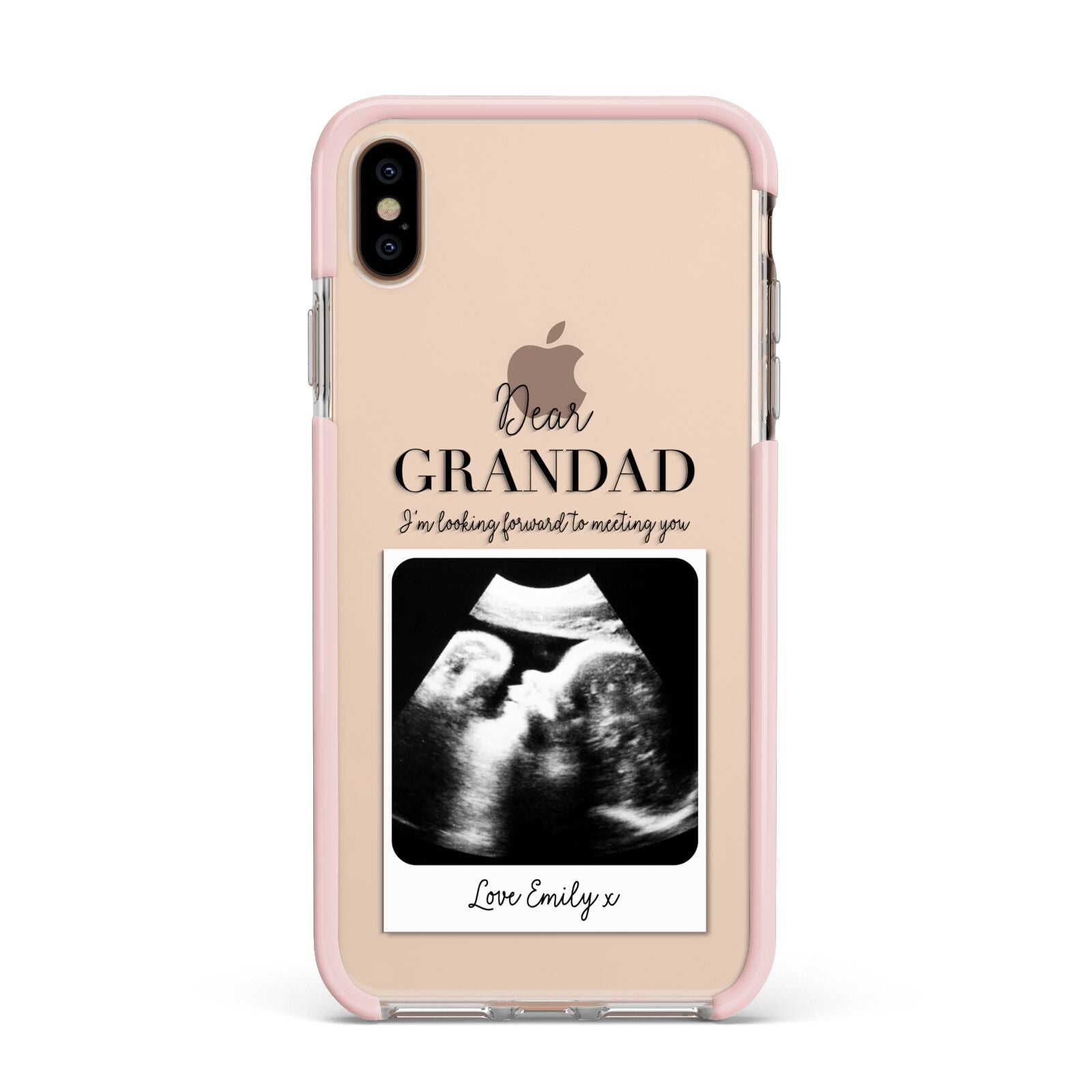 Personalised Baby Scan Photo Upload Apple iPhone Xs Max Impact Case Pink Edge on Gold Phone