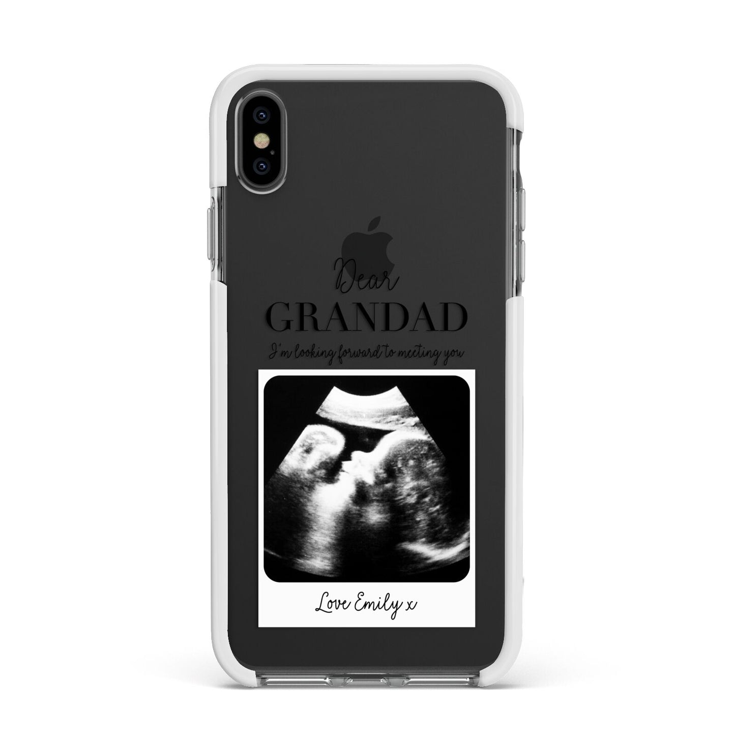 Personalised Baby Scan Photo Upload Apple iPhone Xs Max Impact Case White Edge on Black Phone