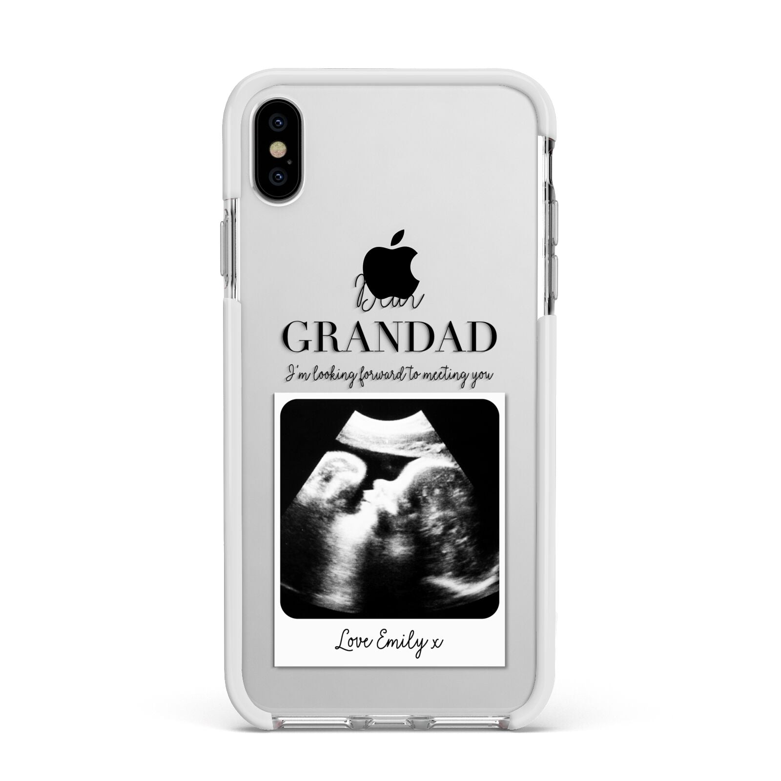 Personalised Baby Scan Photo Upload Apple iPhone Xs Max Impact Case White Edge on Silver Phone