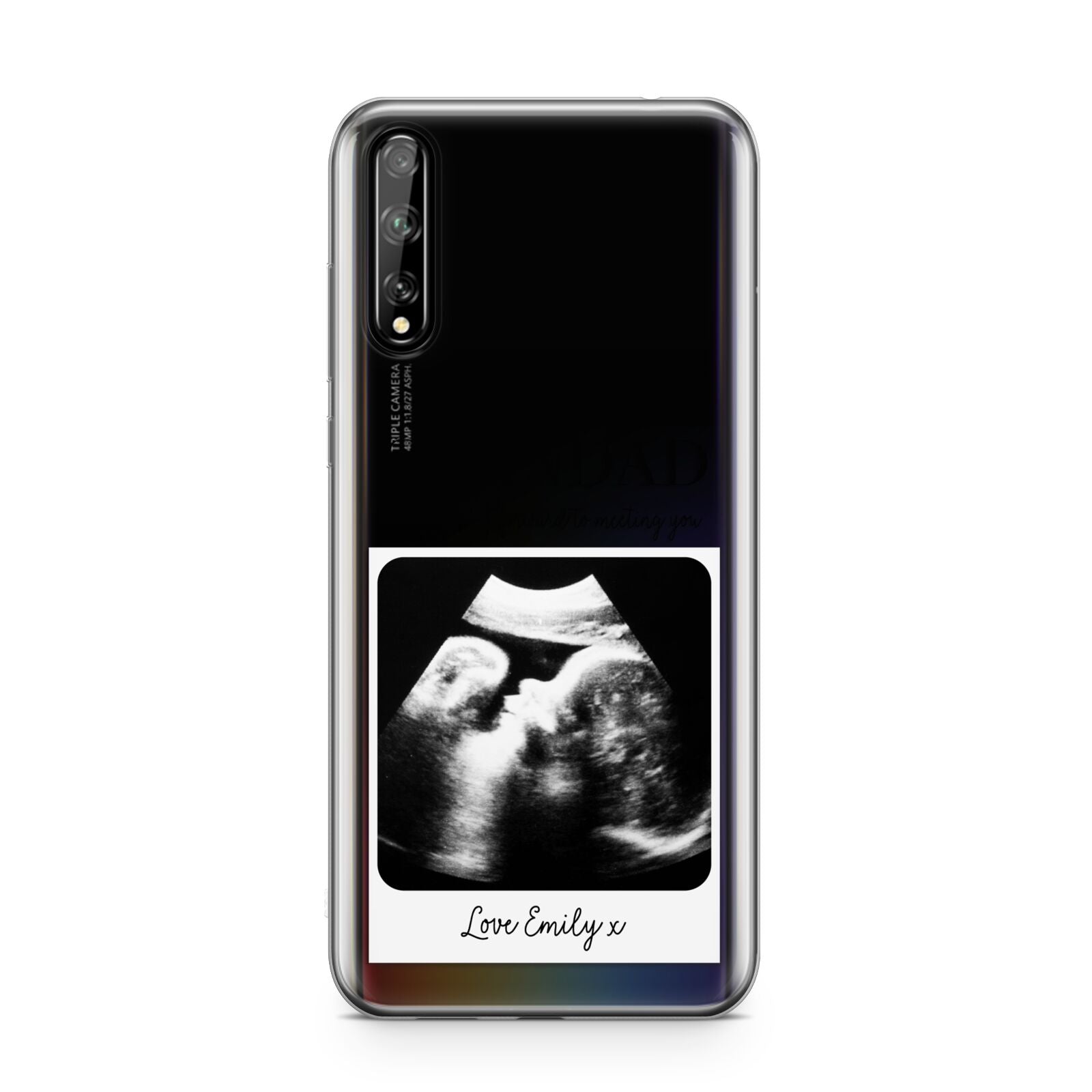 Personalised Baby Scan Photo Upload Huawei Enjoy 10s Phone Case