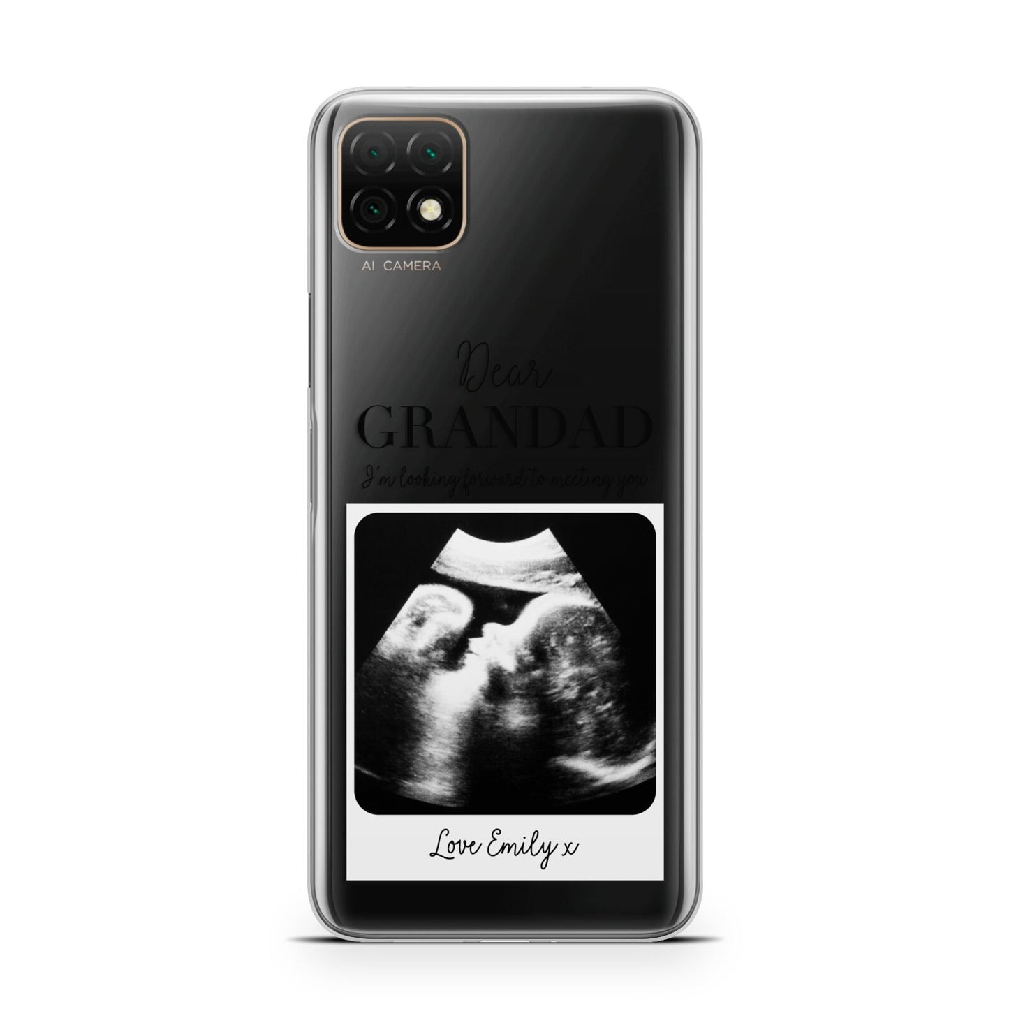 Personalised Baby Scan Photo Upload Huawei Enjoy 20 Phone Case