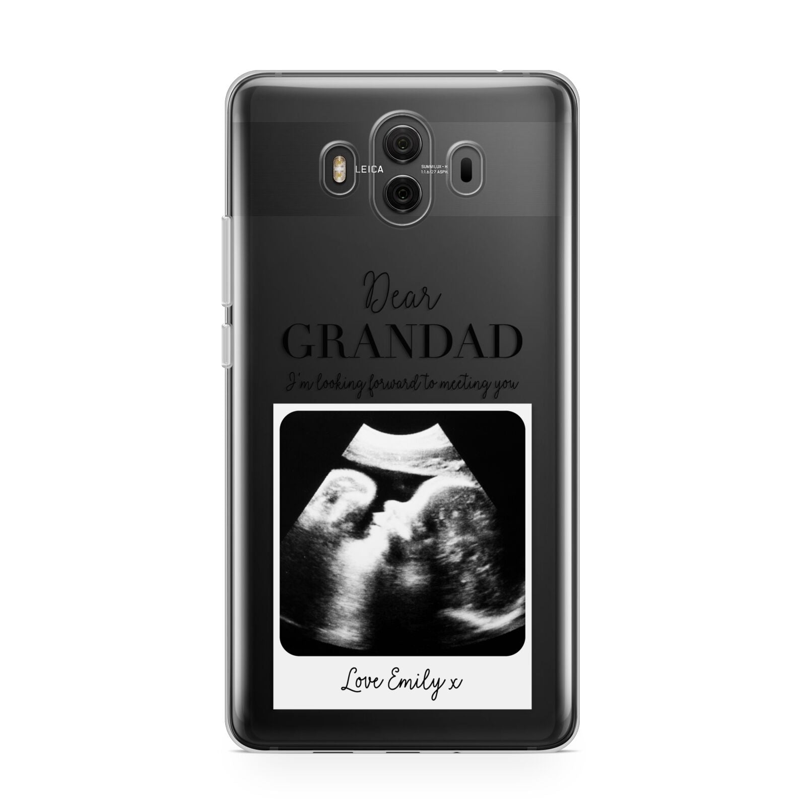 Personalised Baby Scan Photo Upload Huawei Mate 10 Protective Phone Case