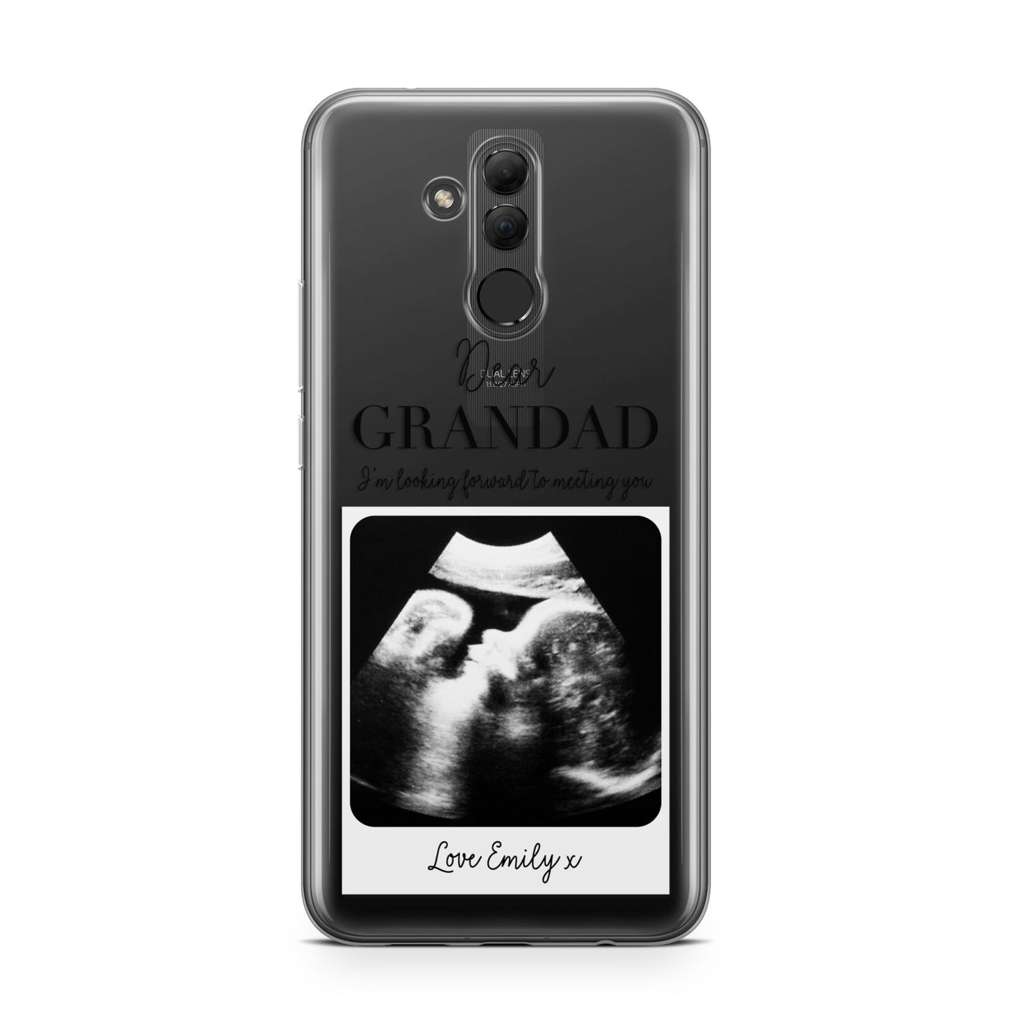 Personalised Baby Scan Photo Upload Huawei Mate 20 Lite