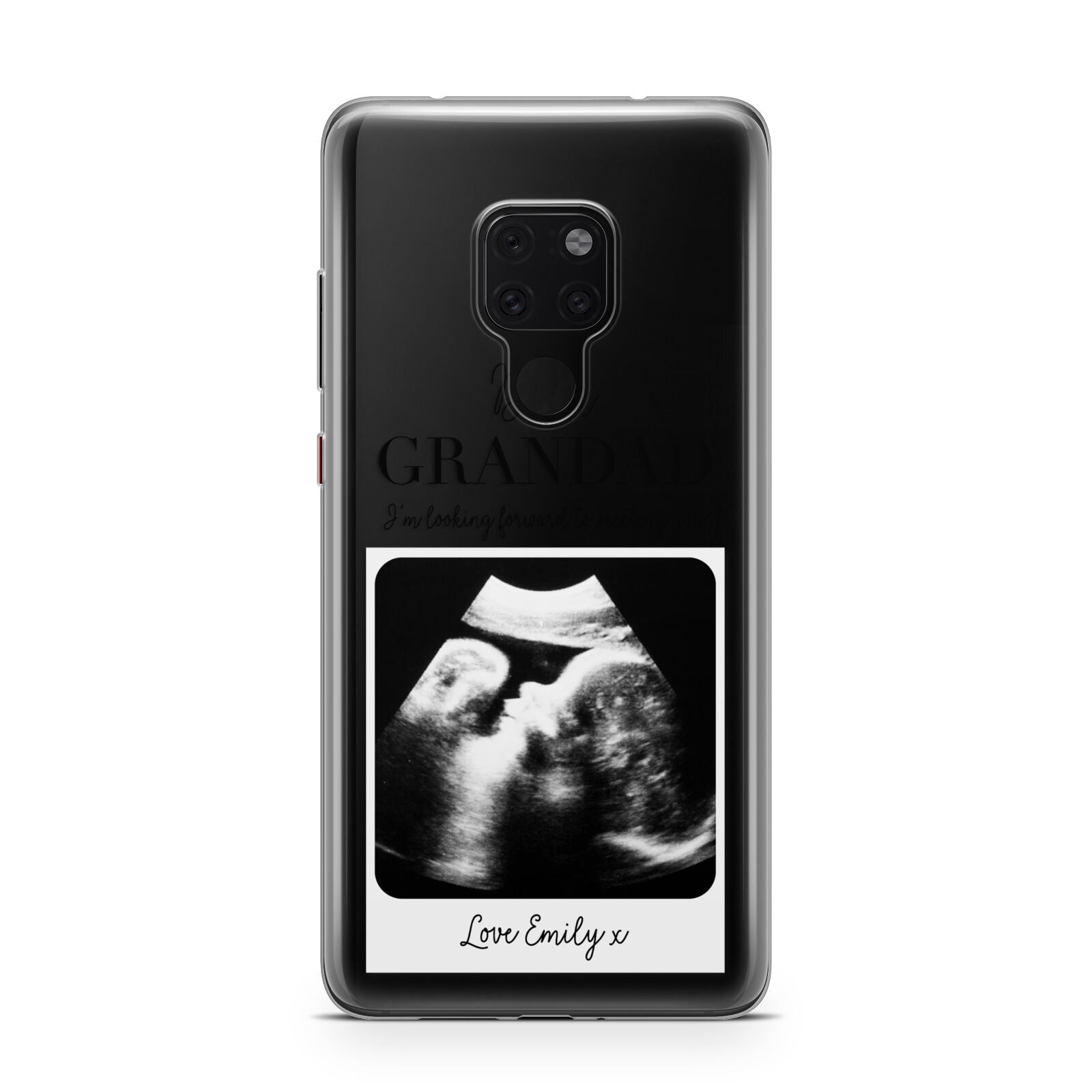 Personalised Baby Scan Photo Upload Huawei Mate 20 Phone Case