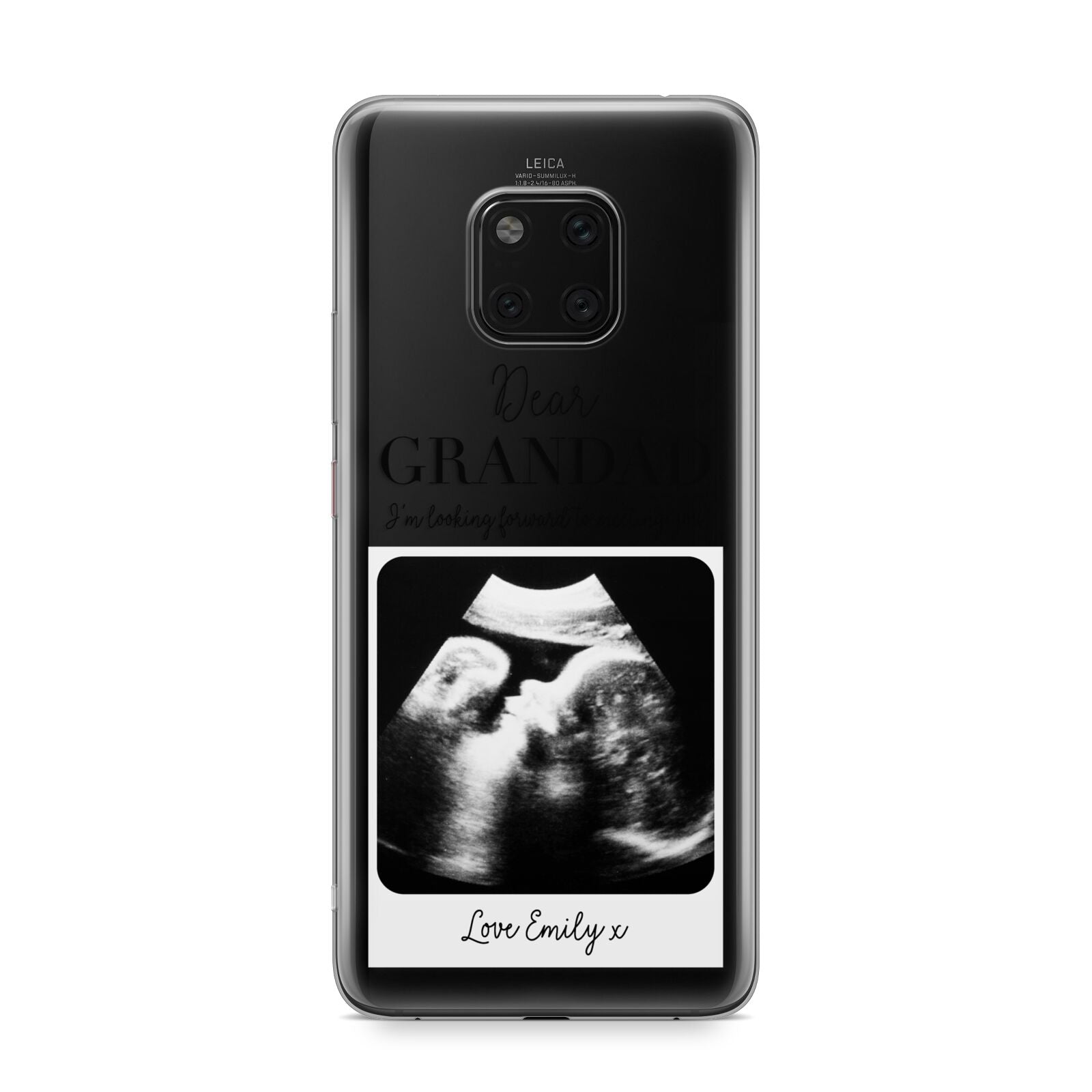 Personalised Baby Scan Photo Upload Huawei Mate 20 Pro Phone Case