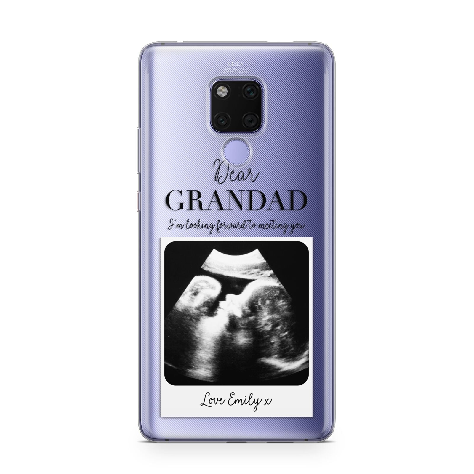 Personalised Baby Scan Photo Upload Huawei Mate 20X Phone Case