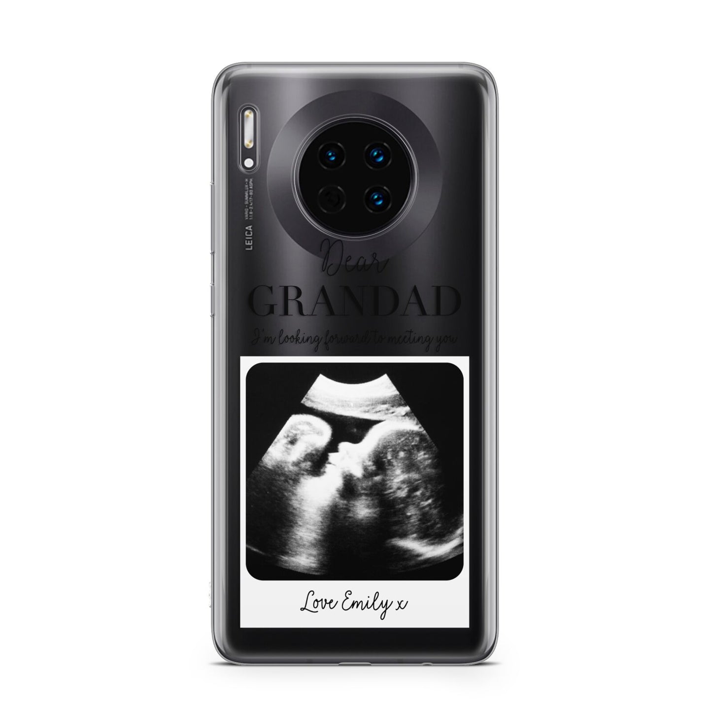 Personalised Baby Scan Photo Upload Huawei Mate 30