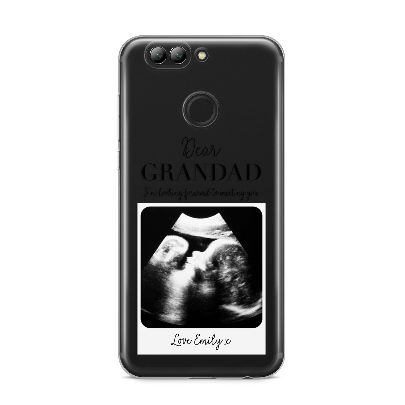 Personalised Baby Scan Photo Upload Huawei Nova 2s Phone Case