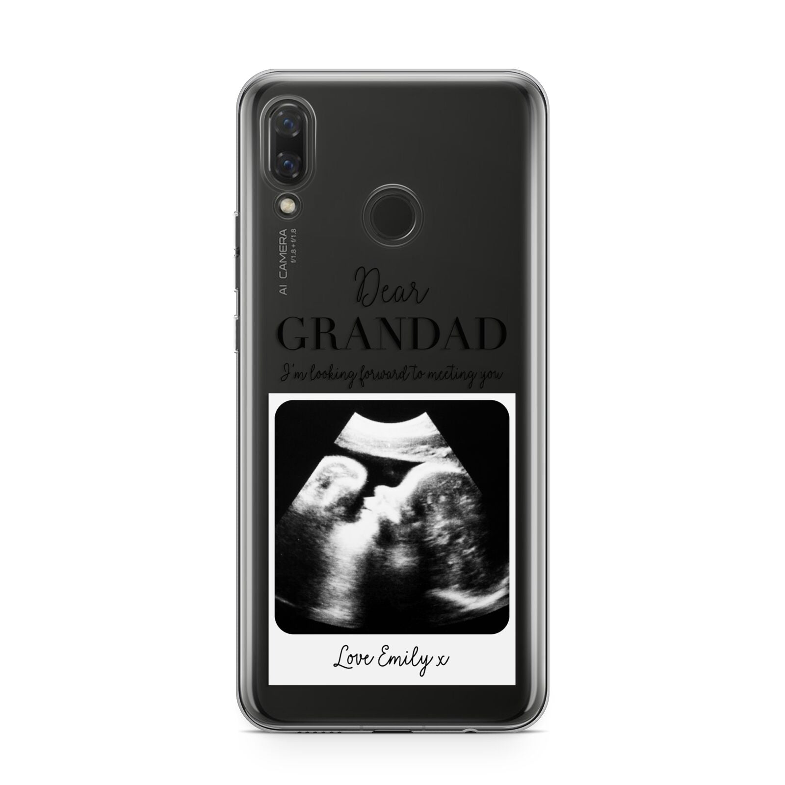 Personalised Baby Scan Photo Upload Huawei Nova 3 Phone Case