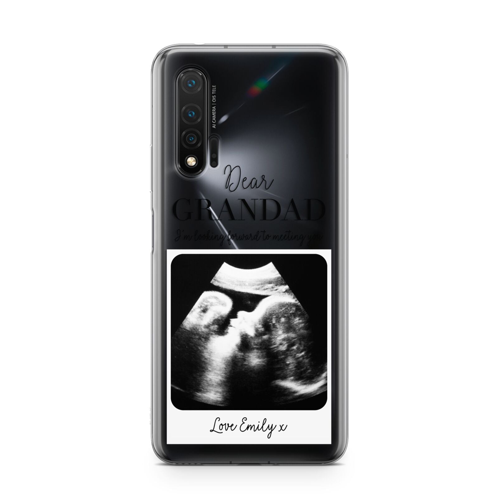 Personalised Baby Scan Photo Upload Huawei Nova 6 Phone Case