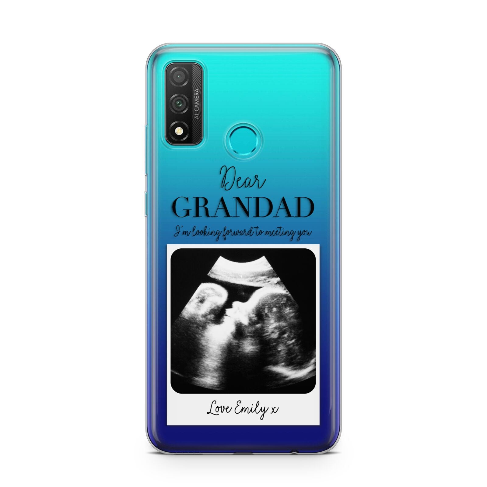 Personalised Baby Scan Photo Upload Huawei P Smart 2020