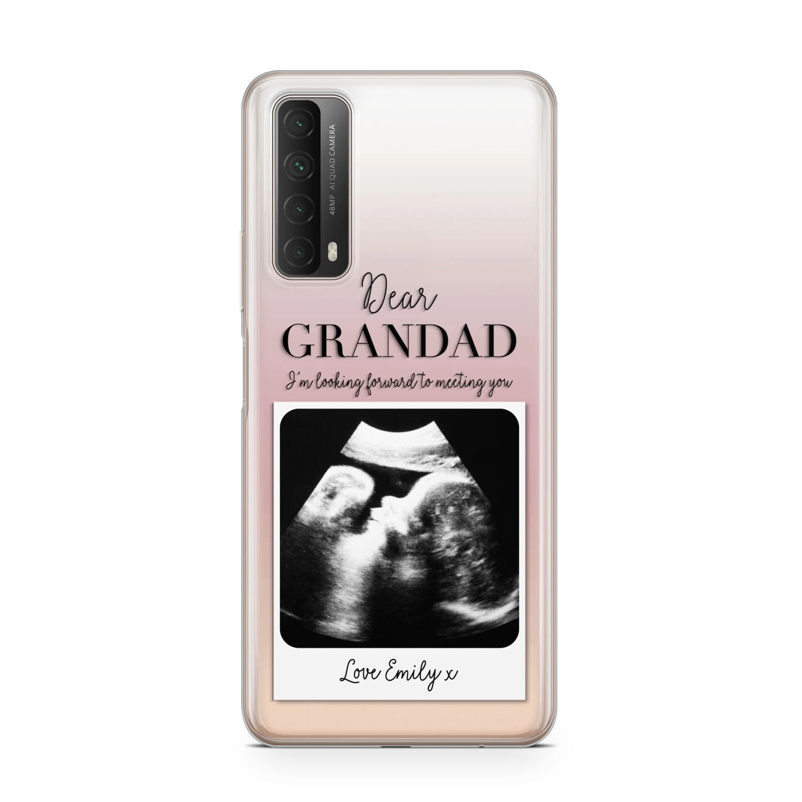 Personalised Baby Scan Photo Upload Huawei P Smart 2021