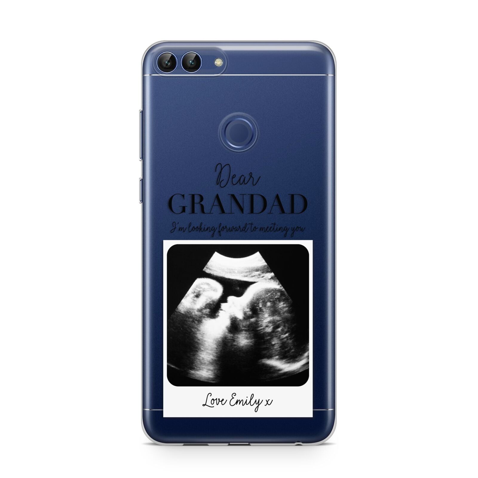 Personalised Baby Scan Photo Upload Huawei P Smart Case