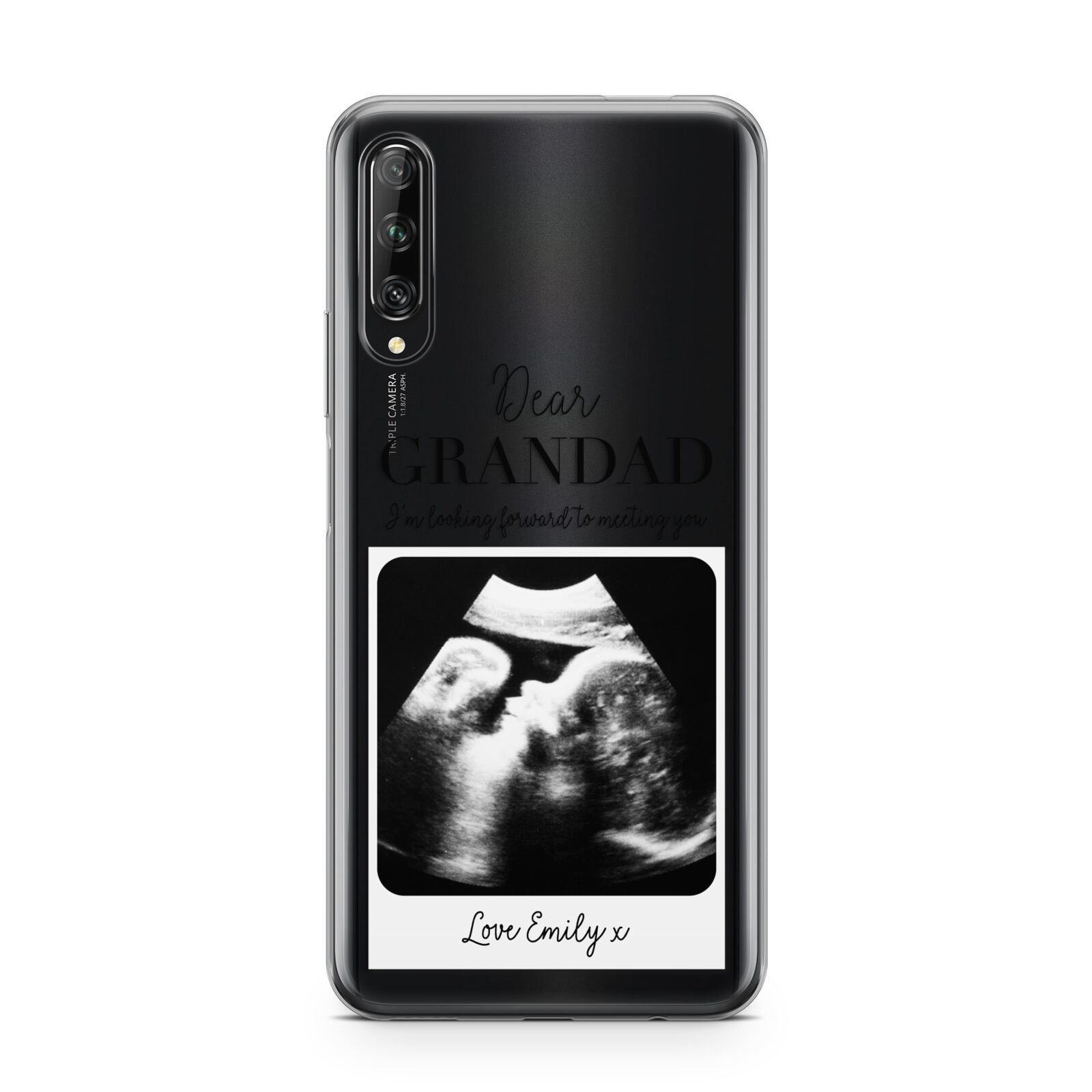 Personalised Baby Scan Photo Upload Huawei P Smart Pro 2019