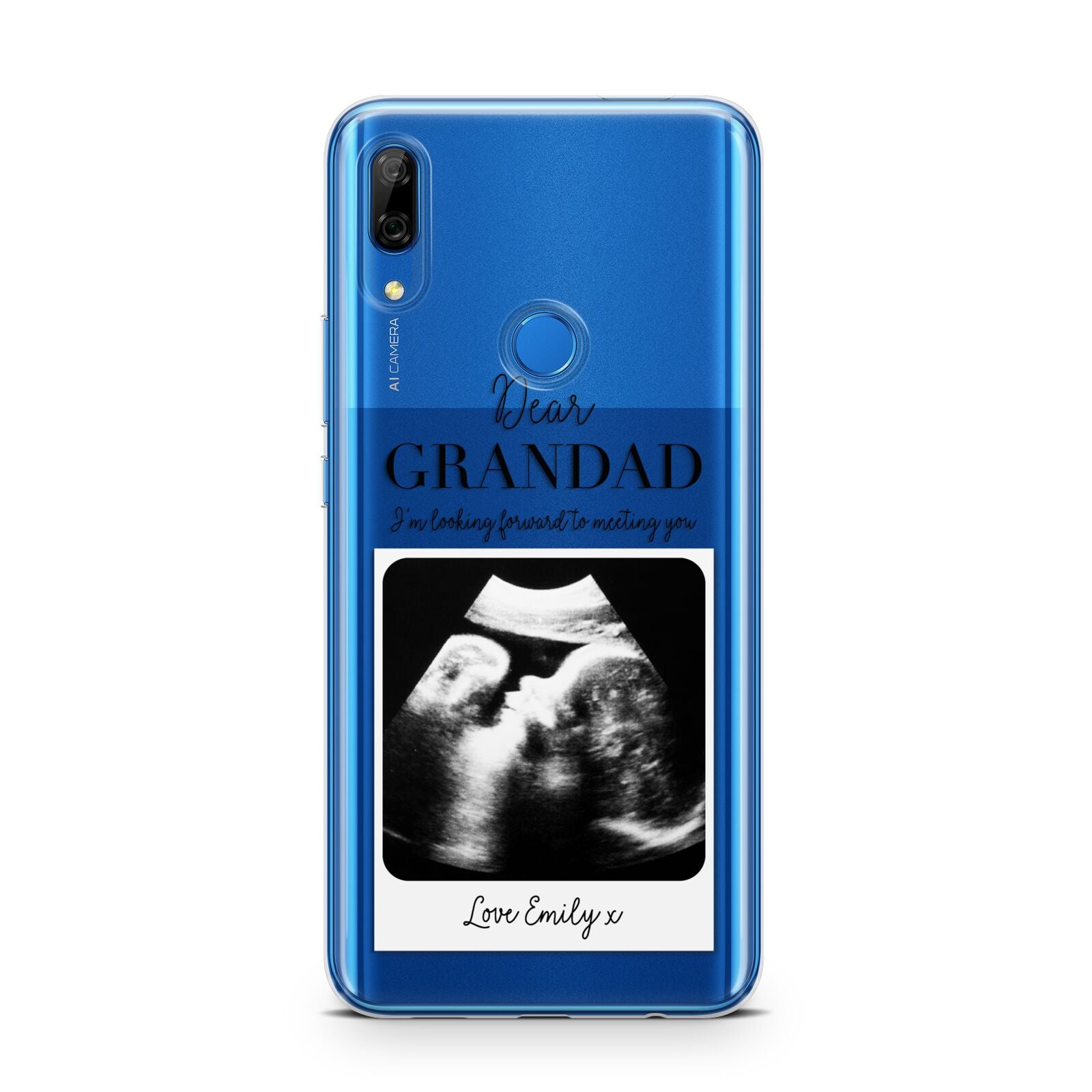 Personalised Baby Scan Photo Upload Huawei P Smart Z