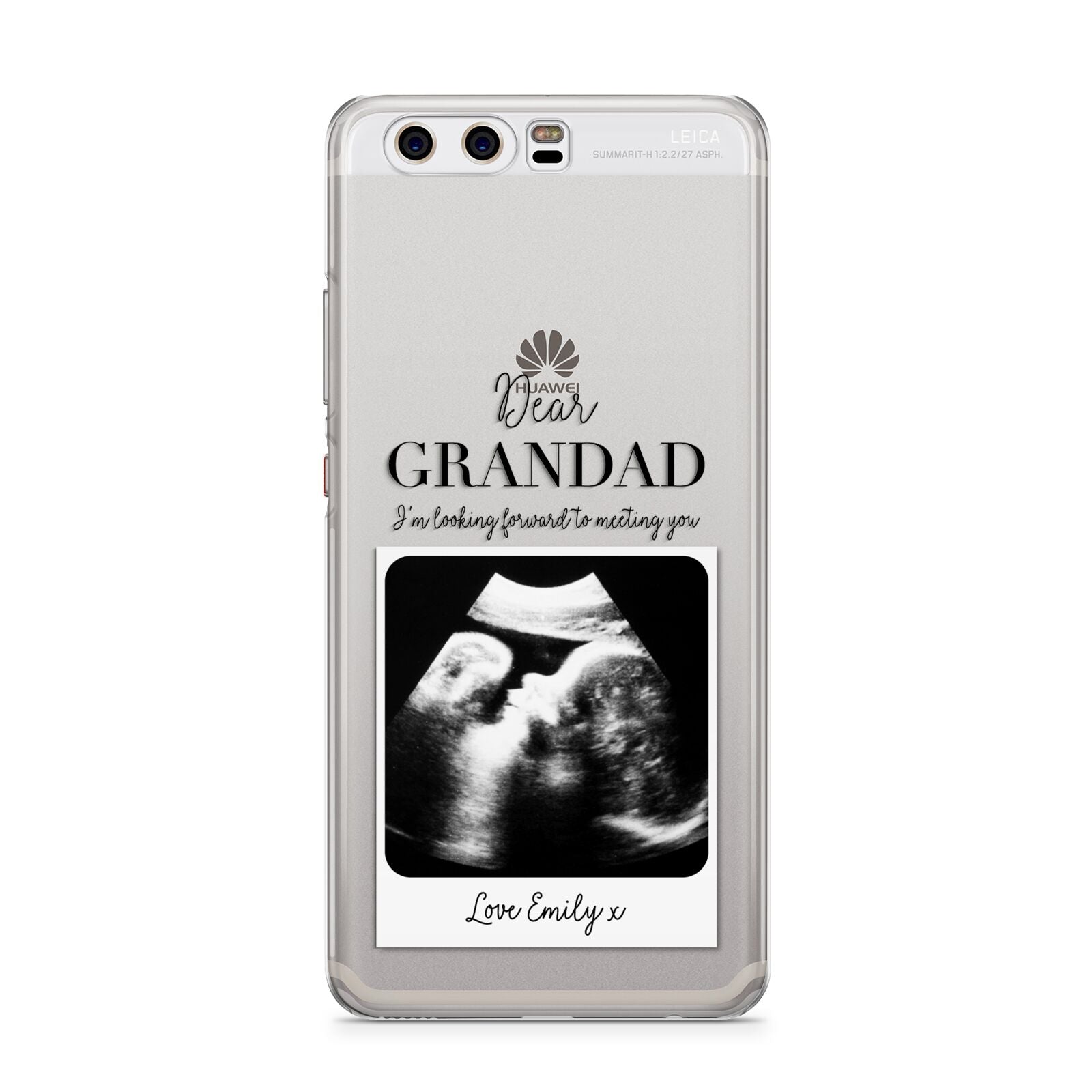 Personalised Baby Scan Photo Upload Huawei P10 Phone Case